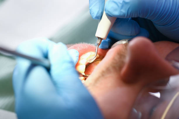 Best Pediatric Emergency Dentist in Macon, MO