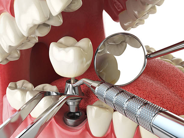 Best Mobile Emergency Dentist in Macon, MO